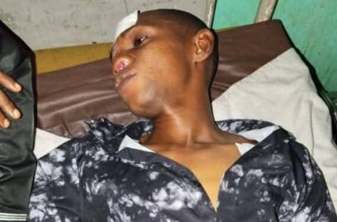 Bumba : un enseignant d’une école privée blessé par balle lors d’un cambriolage à son domicile