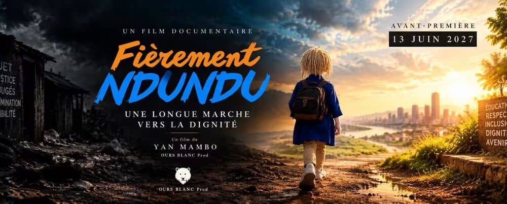 « Une longue marche vers la dignité » : Yan Mambo veut immortaliser le combat des personnes atteintes d’albinisme